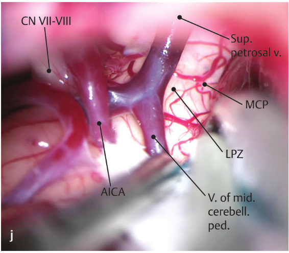 Close-up of a human body anatomy AI-generated content may be incorrect.