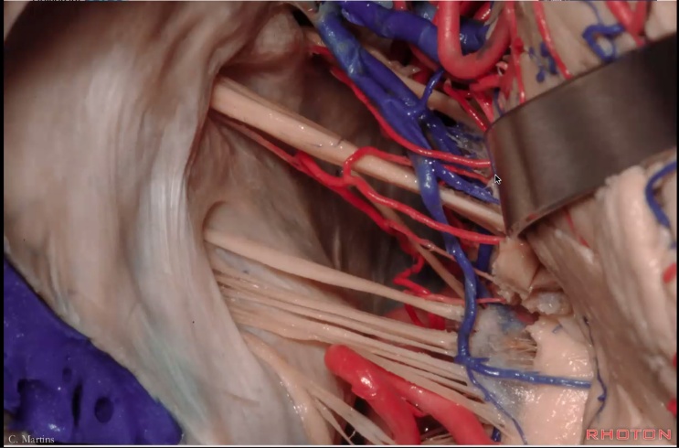 Close-up of a human body AI-generated content may be incorrect.