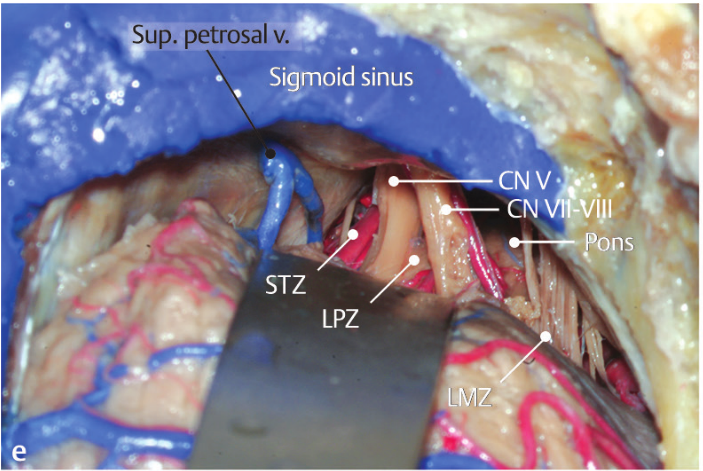 Close-up of a human body AI-generated content may be incorrect.