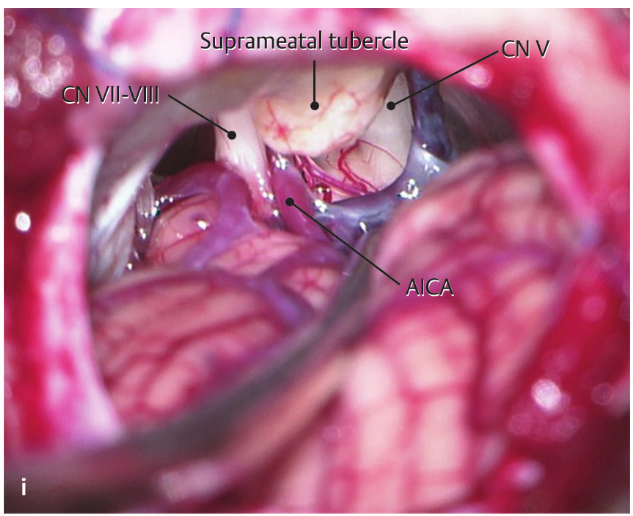 Close-up of a human body AI-generated content may be incorrect.