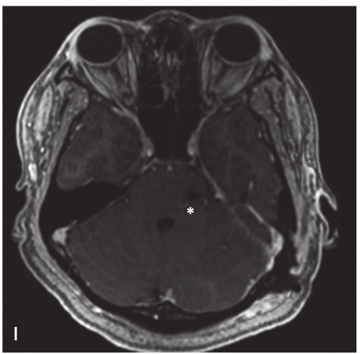 A close-up of a mri scan AI-generated content may be incorrect.