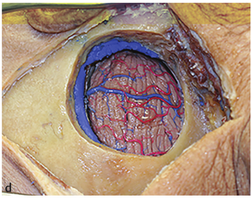 A close-up of a human body AI-generated content may be incorrect.