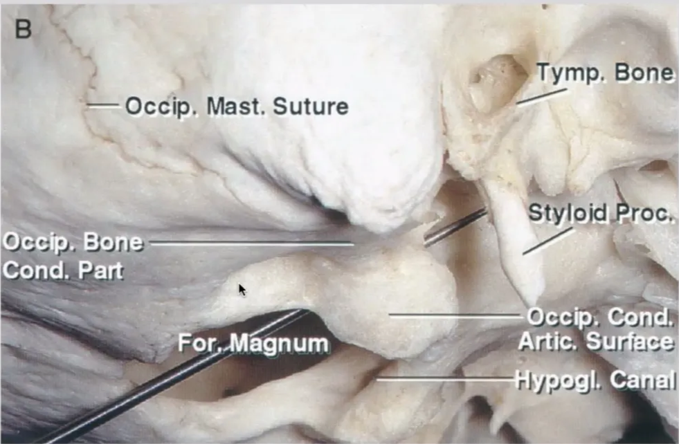 A close-up of a human skull AI-generated content may be incorrect.