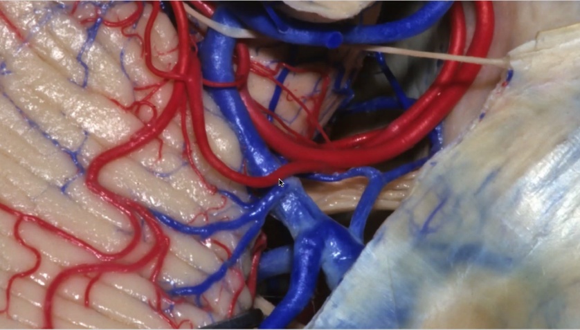 Close-up of a human body veins AI-generated content may be incorrect.