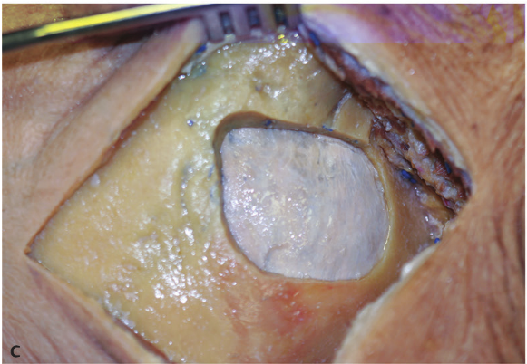 Close-up of a human body AI-generated content may be incorrect.