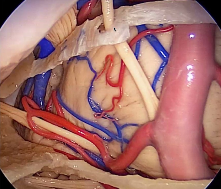 Close-up of a human body AI-generated content may be incorrect.