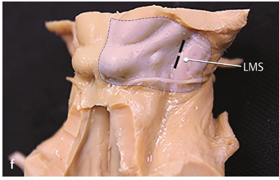 A close-up of a human neck AI-generated content may be incorrect.