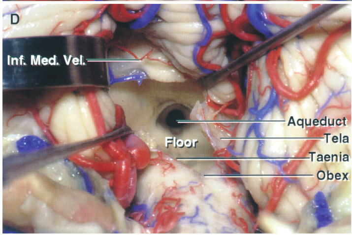 Inf. Med Aq du ela a nid 