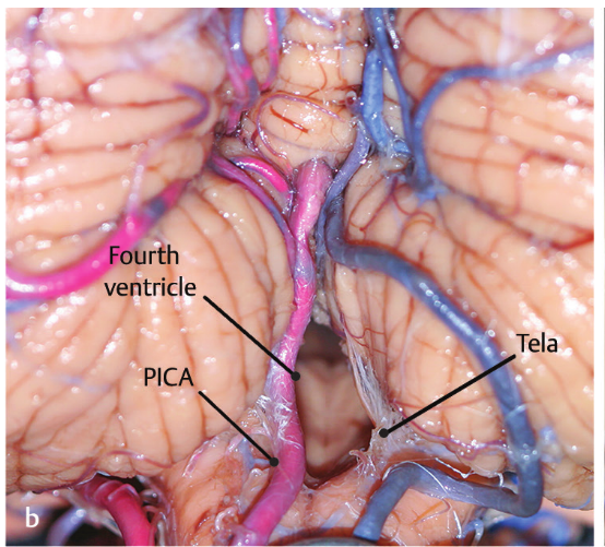Close-up of a human body AI-generated content may be incorrect.