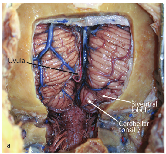 A close-up of a human body AI-generated content may be incorrect.