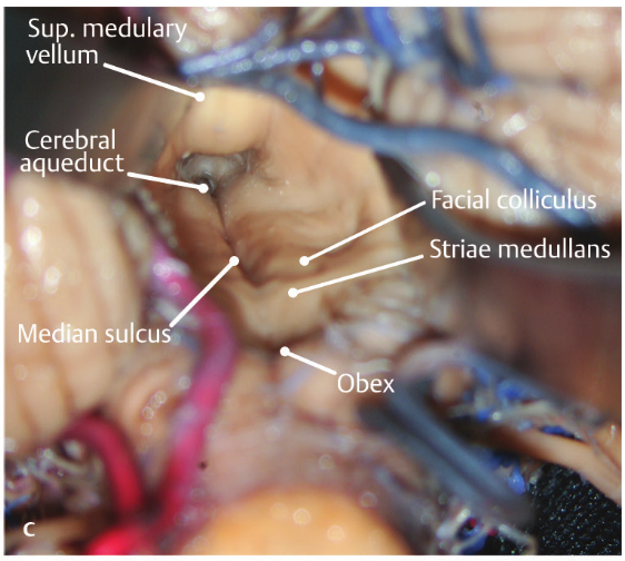 Close-up of a human body AI-generated content may be incorrect.
