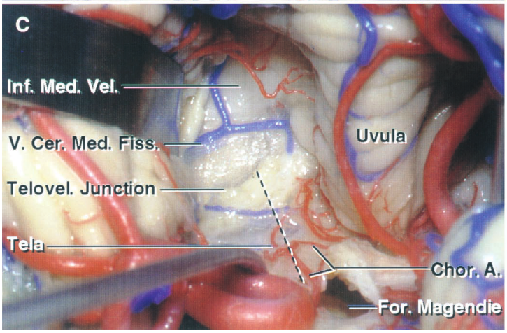 Int. Med Vel. Uvula V. cer Ned, . Telovel. on 