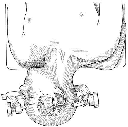 A drawing of a person's head AI-generated content may be incorrect.