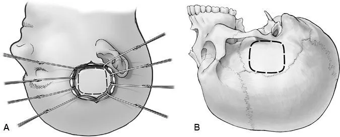 A diagram of the human skull AI-generated content may be incorrect.