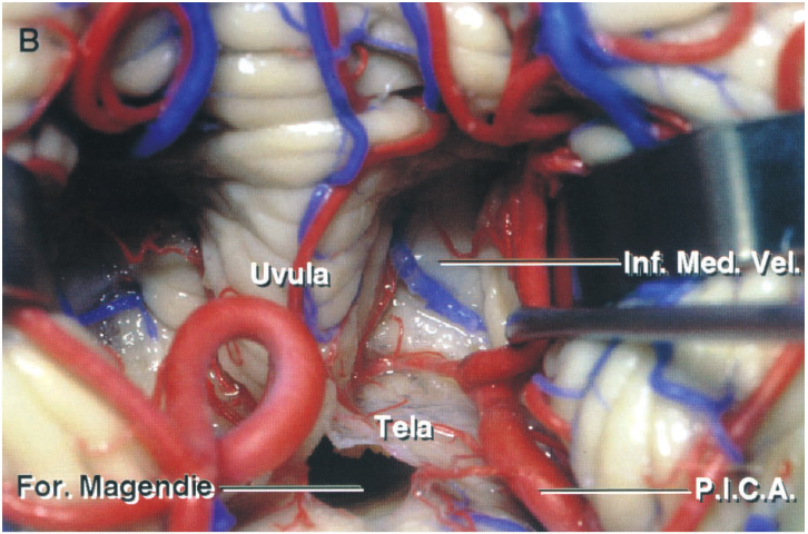 Close-up of a human body AI-generated content may be incorrect.