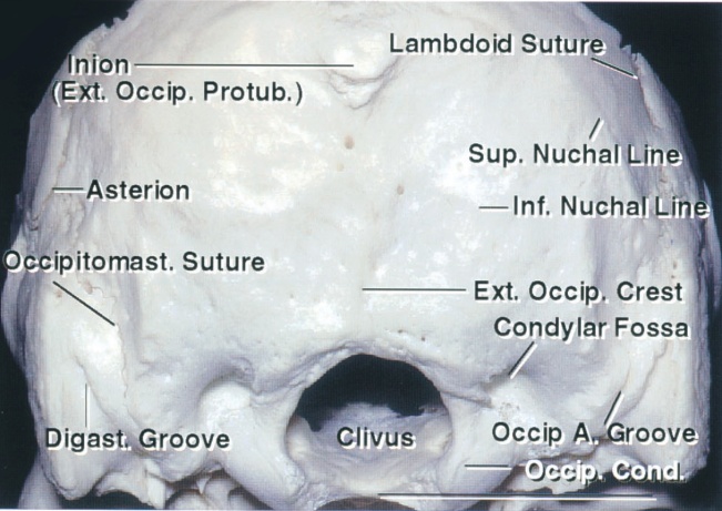 Figure 1: Osteology of the suboccipital bone. The superior nuchal line and inion estimate the locations of the transverse sinuses and torcula, respectively. The asterion is not a reliable landmark for the transverse sigmoid junction dura, and a burr hole over the asterion usually lands on the transverse sinus and places this structure at risk (Image courtesy of AL Rhoton, Jr).