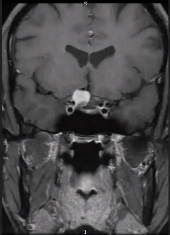 A screenshot of a computer AI-generated content may be incorrect.