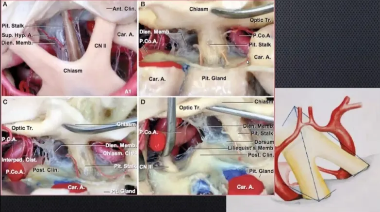 A screenshot of a computer showing anatomy AI-generated content may be incorrect.