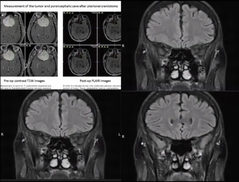 A close-up of a computer screen AI-generated content may be incorrect.