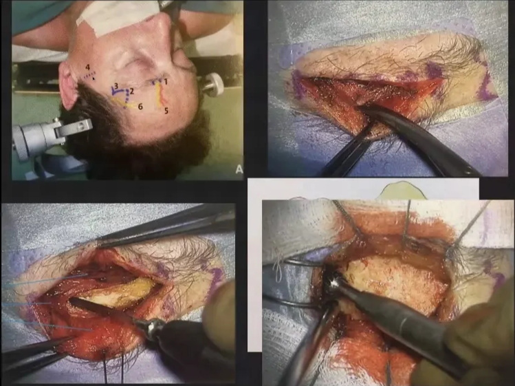 A screenshot of a medical procedure AI-generated content may be incorrect.