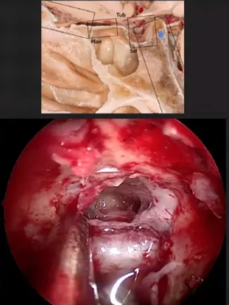 A screenshot of a computer AI-generated content may be incorrect.