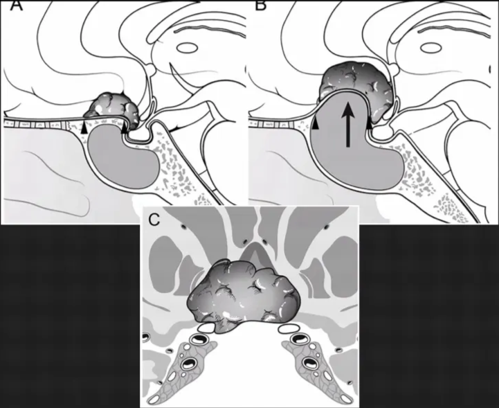 A screenshot of a computer AI-generated content may be incorrect.