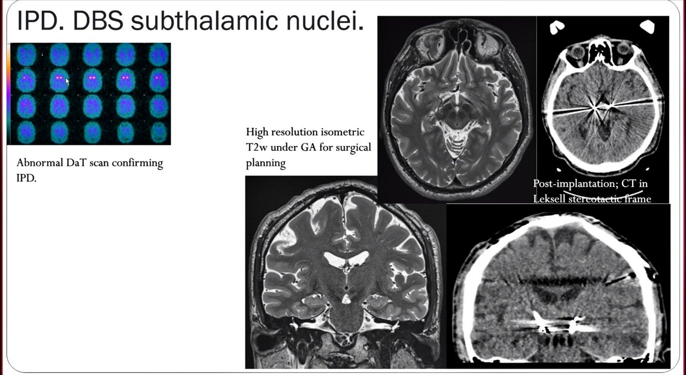 A close-up of a brain scan AI-generated content may be incorrect.