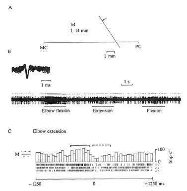 Intraoperative micrælectrode and semi-microelectrode recording during the physiological localization Of the thalamic nucleus ventral CELLS RESPONSIVE TO MOVEMENT pages: First March 2002, 