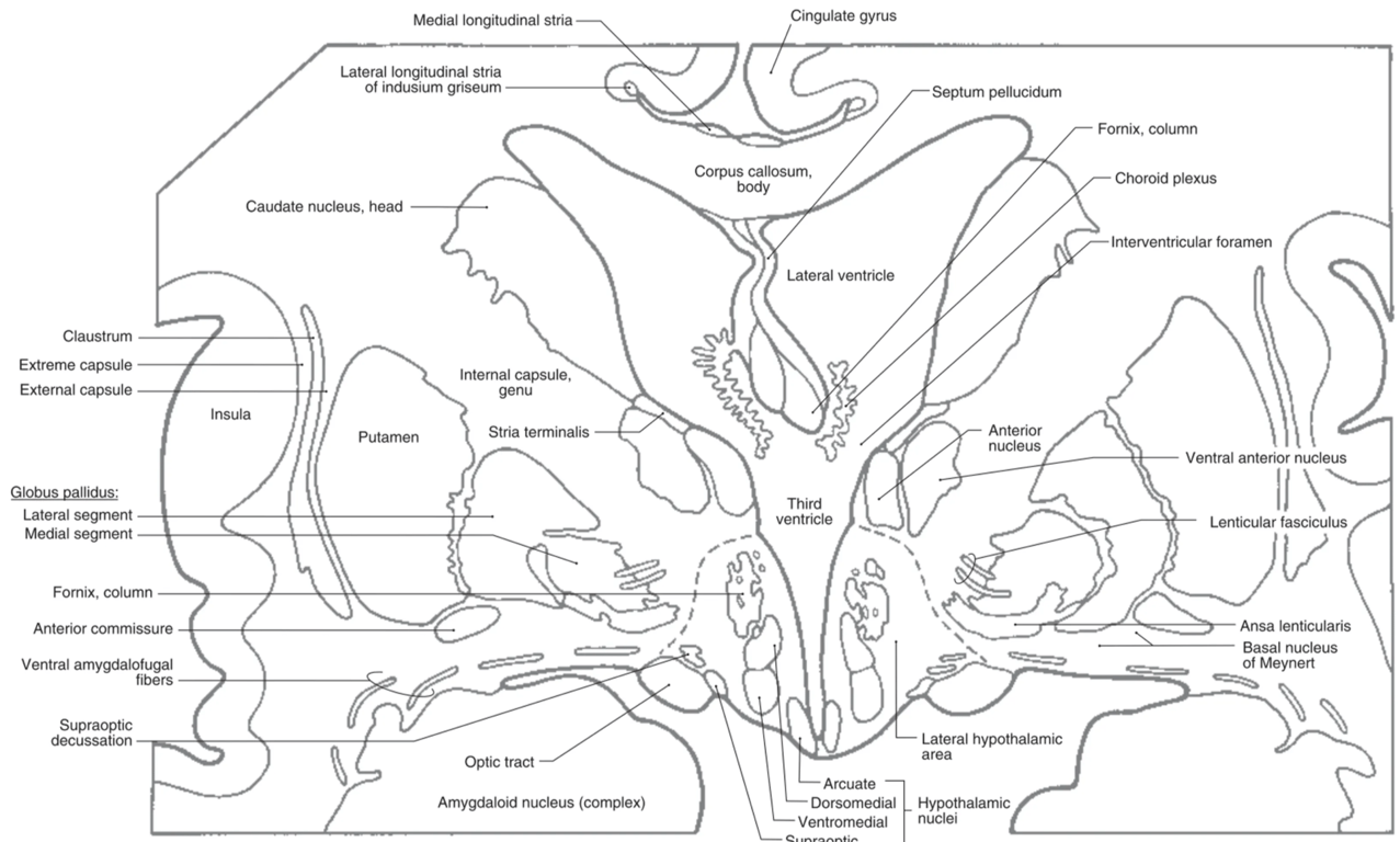 Coronal section of the forebrain through the interventricular foramen, genu of the internal capsule, rostral tip of the dorsal thalamus, and about the middle one-third of the hypothalamus. Many of the structures labeled in this figure can be easily identified in the T1-weighted MRI adjacent to the photograph.