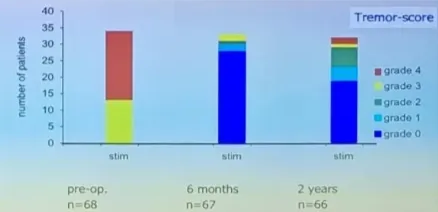 VIM DBS for Tremor Epidemiology ET: Prevalence: 0.4 — 0.9% male > female Pathophysiologie: unknown genetic Cardinal Symptom: Intention tremor Treatment Medications DBS DBS: Tremor not well controlled with meds or side-effects from meds Interferes with patient's quality of life Outcome: Initially > 80 - Longer term. Long term: 40% — 70% 35 30 25 20 15 10 5 o stim pre-op. n=68 stim 6 months n=67 Layud Horsfan Tremor-score grade 4 grade 3 ngrade 2 Ograde 1 •grade O stim 2 years n = 66 Movement Disorders vol. 23, No. S. 2008. pp. 1146-1153 