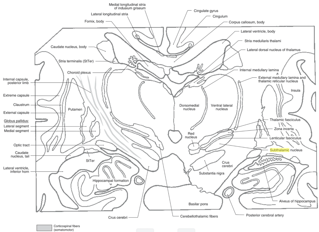 Coronal section of the forebrain through the lateral dorsal nucleus, massa intermedia, and subthalamic nucleus. Many of the structures labeled in this figure can be easily identified in the T1-weighted MRI adjacent to the photograph.