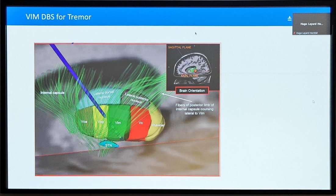 A screenshot of a computer AI-generated content may be incorrect.
