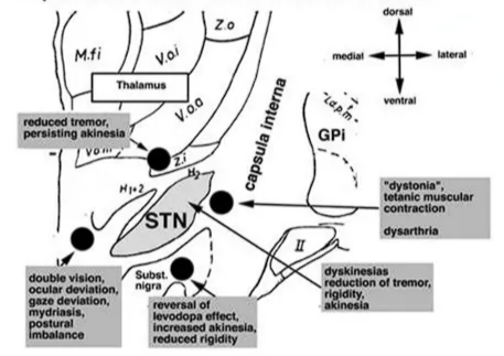 Frontal section 1.5mm behind MCP