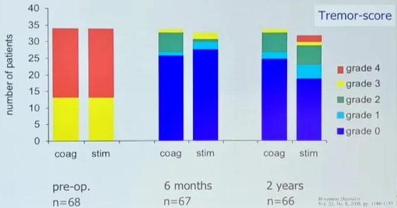 Lesion outcome? A COMPARISON OF CONTINUOUS THALAMIC STIMULATION AND THALAMOTOMY FOR SUPPRESSION OF SEVERE TREMOR P. Rx:nARO SO/uoRu.a••. M.D. D. M.D.. PH.D.. PATR'CK M.M. Bossuy•r. J. M.D.. Eos JW sowye,. mo.. Bf. M.o„ p. PH.D.. ANO D. M B•.D. THE NEW OF 40 35 30 25 20 15 10 5 coag pre-op. n=68 Long-Term Follow-Up of Thalamic Stimulation Versus Thalamotomy for Tremor Suppression p. Richard MD. D. Arklries Bosch. MD. PhD.' Maru«hka p. Menus. and Johannes D. Svxeirnan. MD. Tremor-score grade 4 grade 3 grade 2 •grade 1 •grade 0 stim coag stim coag stim 6 months n=67 2 years n=66 Hugo Layard Hugo Layard Horsf* NHS Movement Disorders Vol. 23. No. S. pp. 
