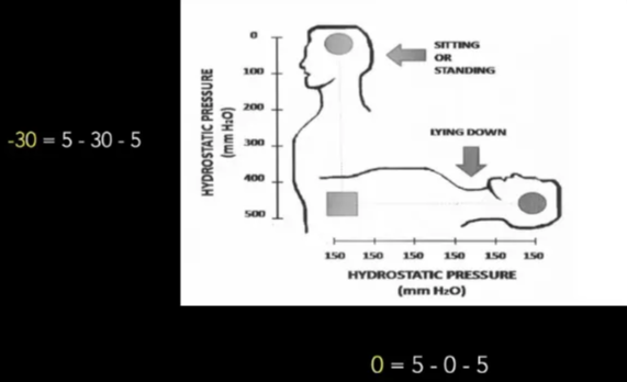 SIPHONING -30=5-30-5 0=5-0-5 