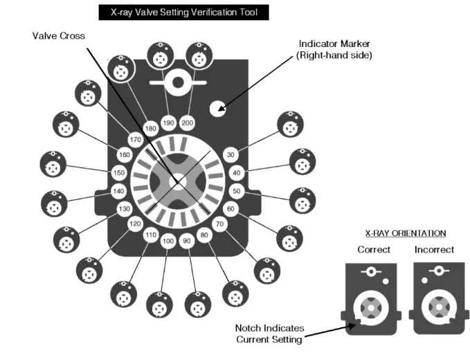 Codman Hakim Programmable Valve setting code X-ray Valve Setting Verification Tool Valve Cross 190 200 IBO 170 160 150 140 130 120 110 100 30 50 60 70 80 90 Indicator (Right-hand side) X-RAY ORIENTATION Correct Incorrect Notch Indicates Current Setting 