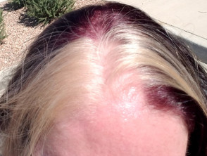 A person's head with red hair AI-generated content may be incorrect.