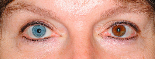 A close up of a person's eyes AI-generated content may be incorrect.