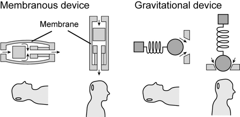 vlembranous device Membrane Gravitational device 