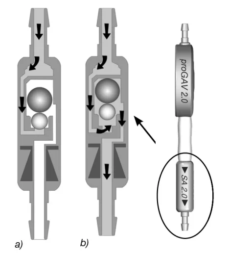 The intraventricular pressure (IVP) of the patient is increased and the spring force which would otherwise keep the differential pressure unit closed is overcome. Now, the sealing ball moves out of the cone and a gap is sealing for liquor drainage. Vertical position When the patient moves into an upright posi- tion, in that moment the gravitational unit closes (fig. 4a). Now, additionally to the opening pres- sure of the adjustable DP-unit, the weight of the tantalum ball has to be exceeded (open- ing pressure of the gravitational unit), thus the opening pressure of the proGAV 2.0 is signifi cantly increased. Only when the sum of the IVP and the hydrostatic pressure exceeds the opening pressure of the proGAV 2. O, drainage will be possible again (fig. 4b). a) b) Fig. 4: Gravitational unit in vertical body position a) closed b) open During physical activity which is associated with vibrations (for example jogging) the opening pressure of the proGAV 2.0 can decrease tem- porarily by 25 % to 35 % according to labo- ratory results. This affects both the individual valve and the combination with a gravita- tional unit. As a basic principle, functionality is retained. At the end of physical activity, the opening pressure returns to its original level and remains stable. 