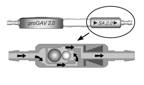 Horizontal position In the horizontal position, the gravitational unit is always open and does not present any resis- tance. proGAV 2.0 Fig. 2: Gravitational unit in horizontal body position Consequently, the opening pressure of the pro- GAV 2.0 in the horizontal body position is char- acterised by the adjustable differential pressure unit. The principal working method used by the adjustable differential pressure unit is shown in fig. 3a and b. In fig. 3a it is closed so that no drainage is pos- sible. In fig. 3b, the adjustable differential pres- sure unit is shown in the open state. proGAV2.O a) b) Fig. 3: Adjustable differential pressure unit in horizontal body position a) closed b) open 
