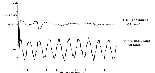 UVLT HqFepnrv After unplugging OR table Before unplugging OR table 