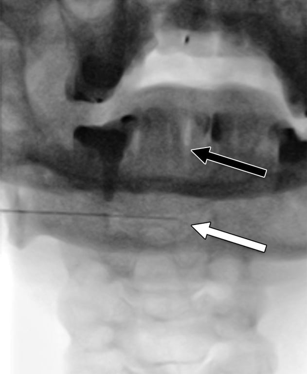 An x-ray of a person's mouth AI-generated content may be incorrect.