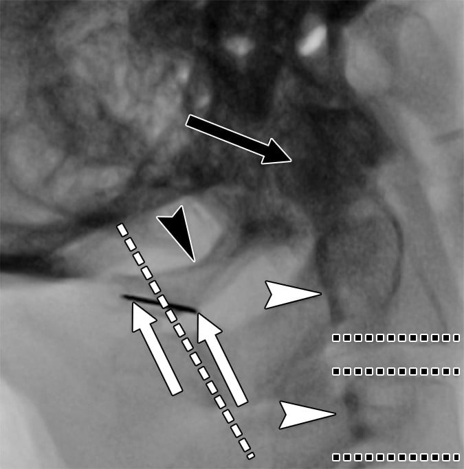 An x-ray of a person's body AI-generated content may be incorrect.