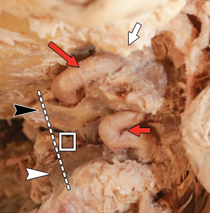 Close-up of a human body AI-generated content may be incorrect.