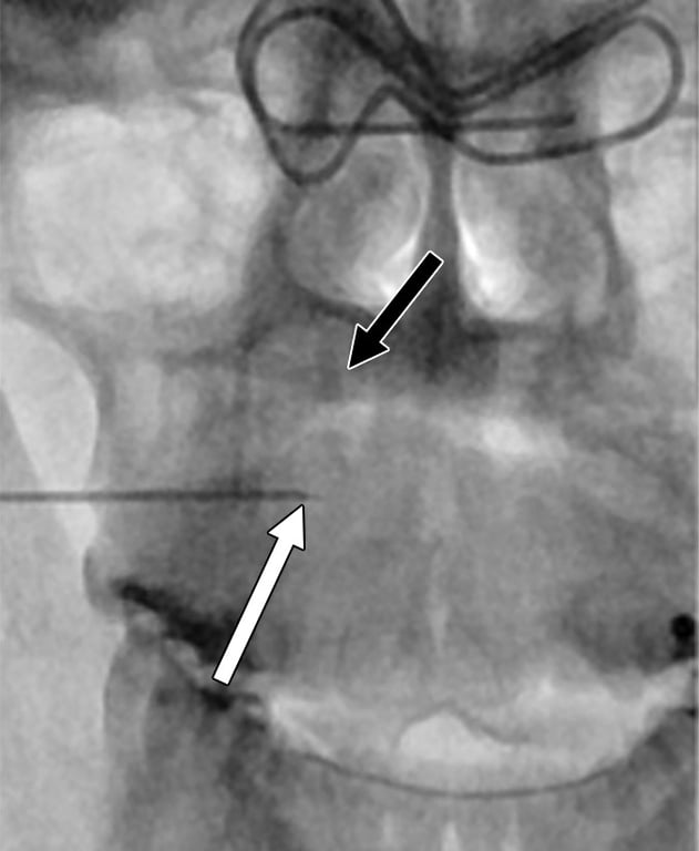 An x-ray of a human body AI-generated content may be incorrect.
