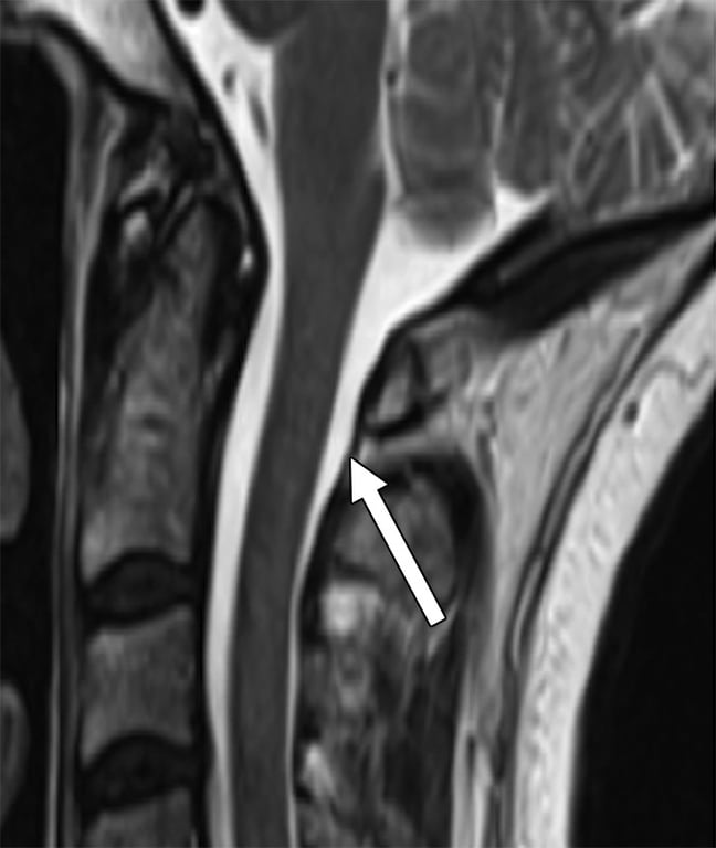 An x-ray of a person's body AI-generated content may be incorrect.