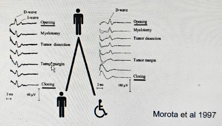 МусАо1оаву ДвзсС1»са Муевотяу оагдт et al 1997 