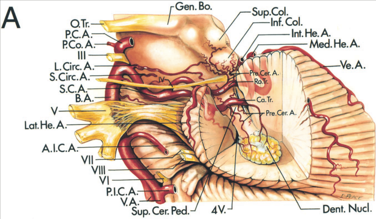 Left lateral view of the SCA with part of the cerebellum removed to show the termination of the superior cerebellar peduncle in the dentate nucleus. 