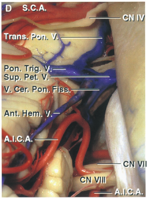 .C.A. Trans. Pon. Trig, sup. Pet V. Ant. em, A.IC.A. c CN VJllí 